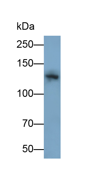 Monoclonal Antibody to Tyrosine Kinase 2 (Tyk2)