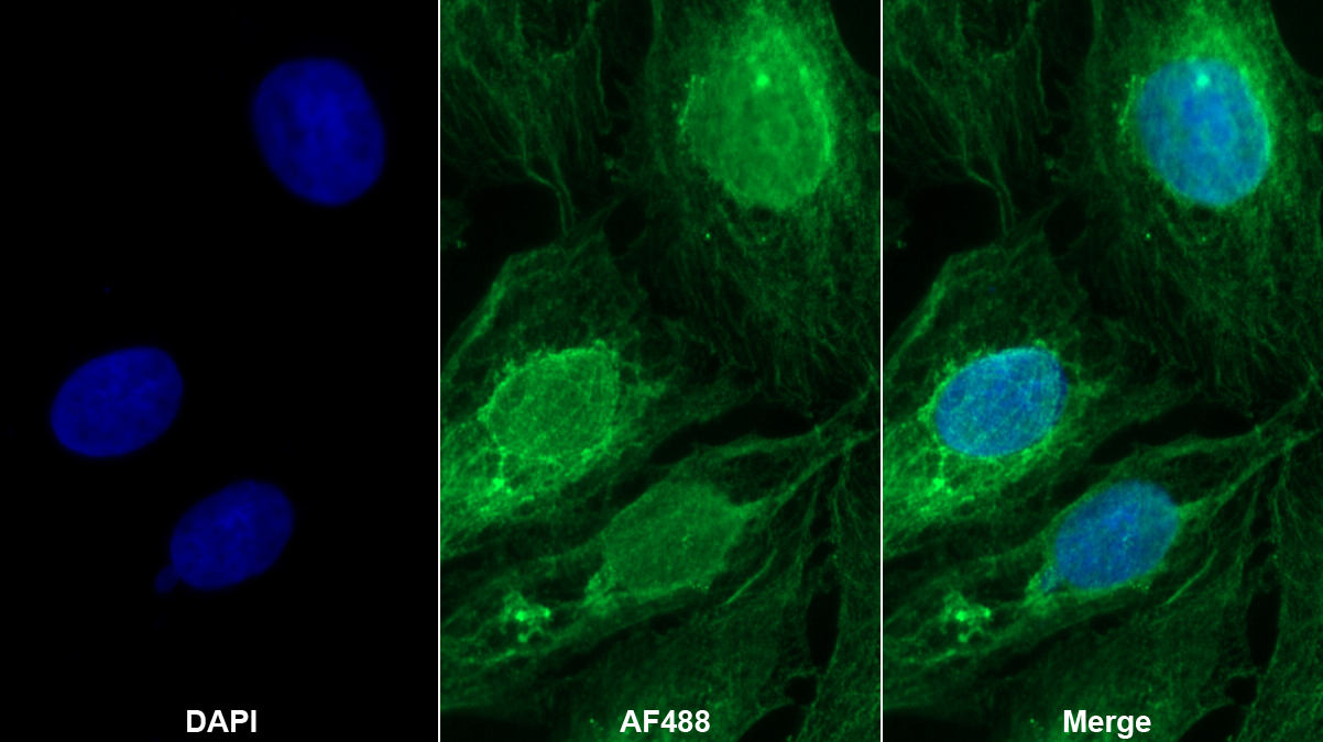 Monoclonal Antibody to Tyrosine Kinase 2 (Tyk2)