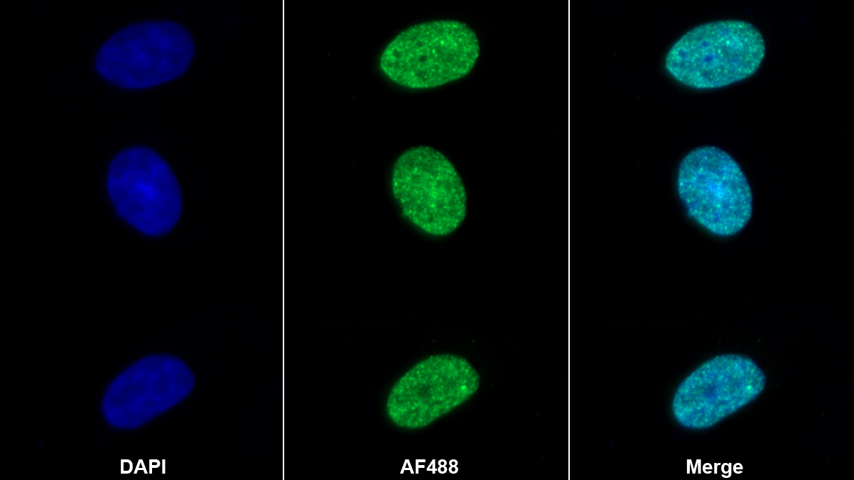 Monoclonal Antibody to Tyrosine Kinase 2 (Tyk2)