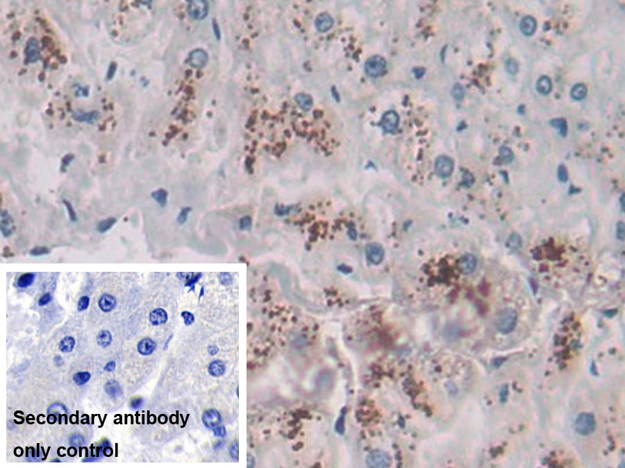 Monoclonal Antibody to Cytosolic Phospholipase A2 (PLA2G4)