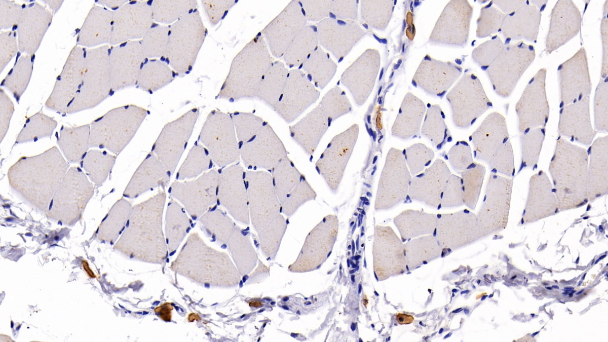 Monoclonal Antibody to Chemokine C-C-Motif Receptor 7 (CCR7)