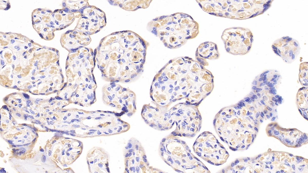 Monoclonal Antibody to Major Basic Protein (MBP)