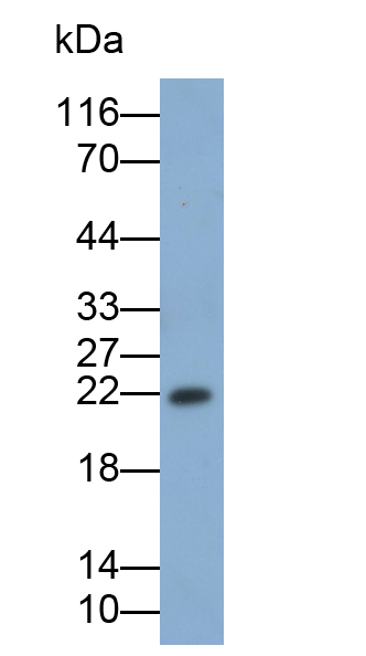 Monoclonal Antibody to Major Basic Protein (MBP)