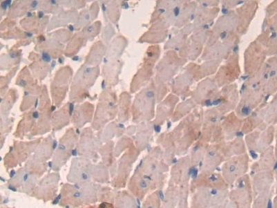 Monoclonal Antibody to Major Basic Protein (MBP)