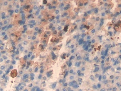 Monoclonal Antibody to Major Basic Protein (MBP)