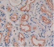 Monoclonal Antibody to Myostatin (MSTN)