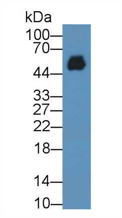 Monoclonal Antibody to Immunoglobulin G2 (IgG2)