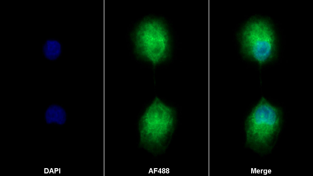 Monoclonal Antibody to B-Cell Activating Factor (BAFF)