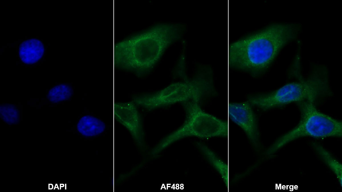 Monoclonal Antibody to Interleukin 28A (IL28A)