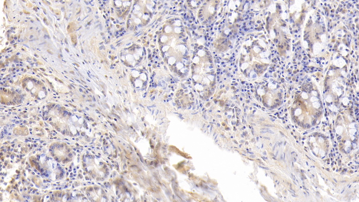 Monoclonal Antibody to Fatty Acid Binding Protein 4 (FABP4)