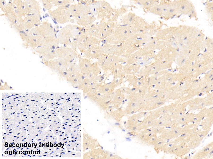 Monoclonal Antibody to Fatty Acid Binding Protein 4 (FABP4)