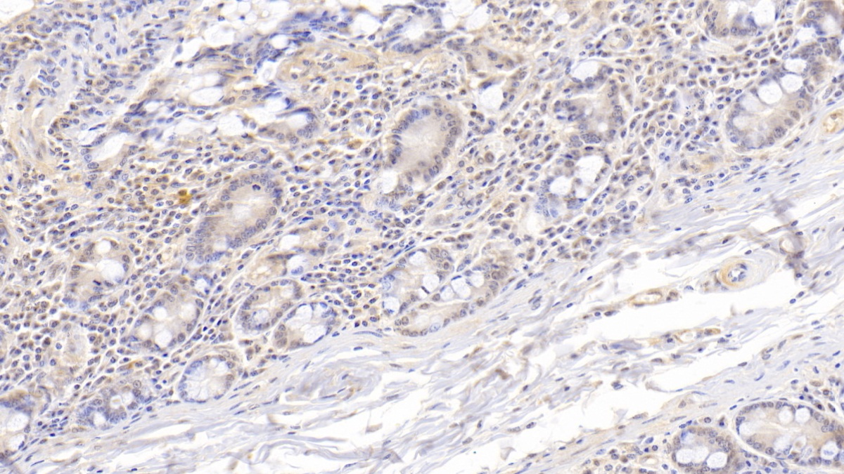 Monoclonal Antibody to Fatty Acid Binding Protein 4 (FABP4)