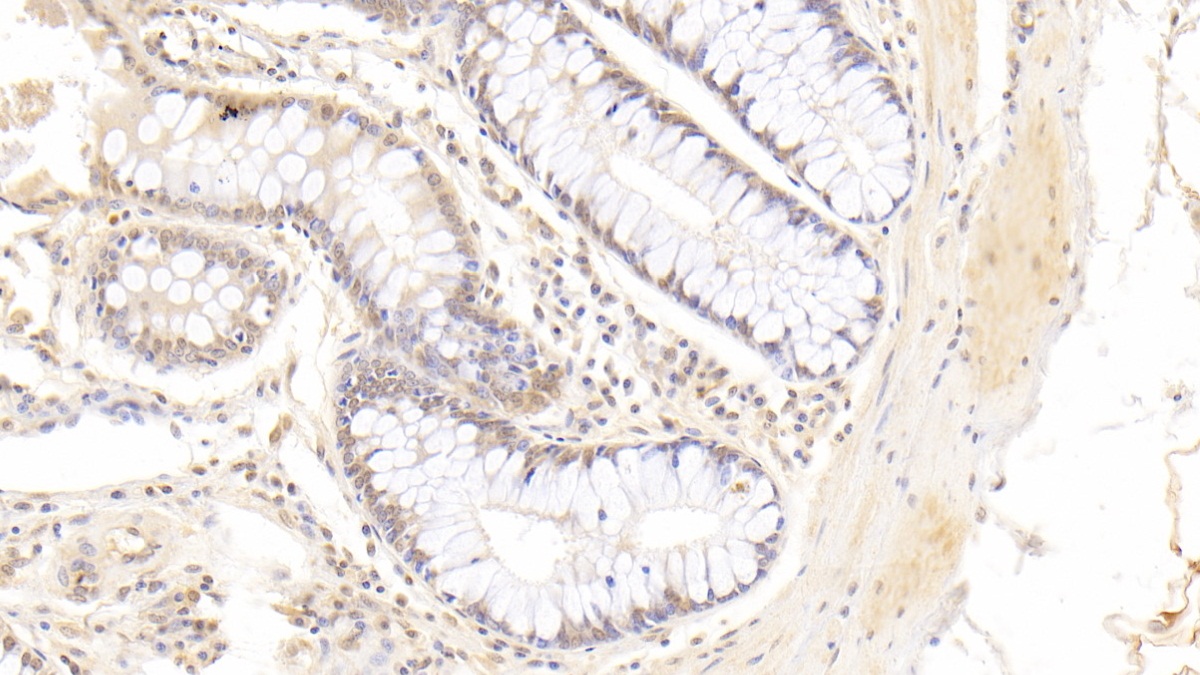 Monoclonal Antibody to Fatty Acid Binding Protein 4 (FABP4)