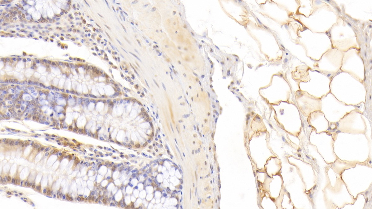 Monoclonal Antibody to Fatty Acid Binding Protein 4 (FABP4)