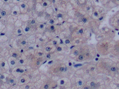 Monoclonal Antibody to Vascular Endothelial Growth Factor 165 (VEGF165)