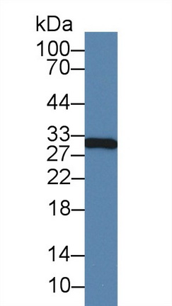 Monoclonal Antibody to Vascular Endothelial Growth Factor 165 (VEGF165)