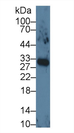 Monoclonal Antibody to Vascular Endothelial Growth Factor 165 (VEGF165)