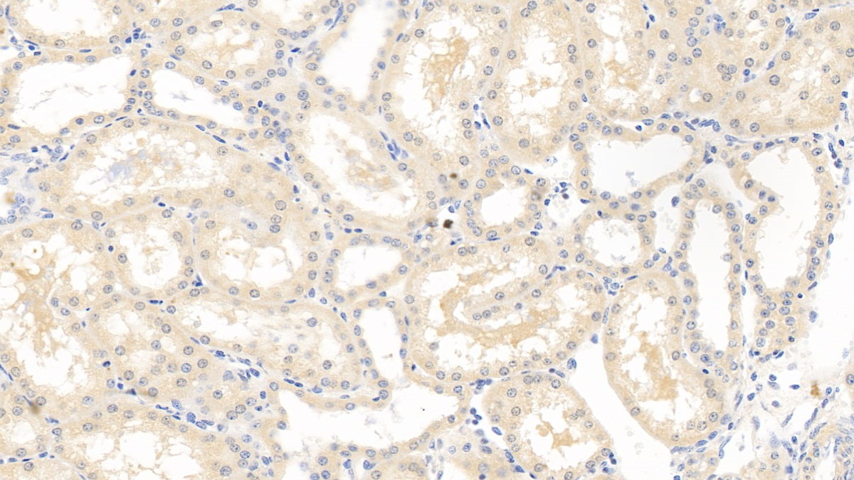 Monoclonal Antibody to Vascular Endothelial Growth Factor 165 (VEGF165)