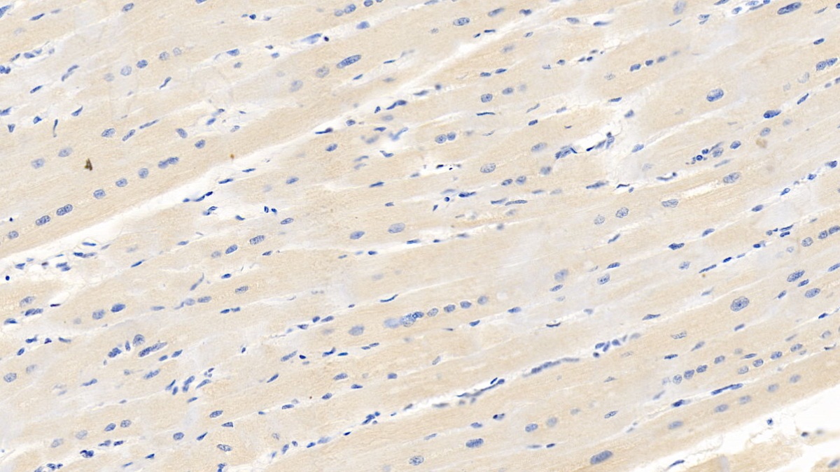 Monoclonal Antibody to Vascular Endothelial Growth Factor 165 (VEGF165)