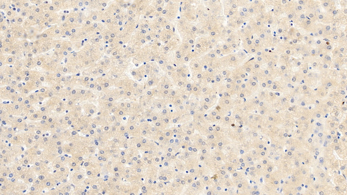 Monoclonal Antibody to Vascular Endothelial Growth Factor 165 (VEGF165)