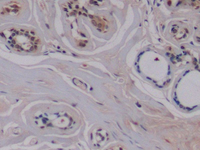 Monoclonal Antibody to Vascular Endothelial Growth Factor 165 (VEGF165)