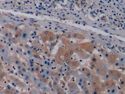 Monoclonal Antibody to Vascular Endothelial Growth Factor 165 (VEGF165)