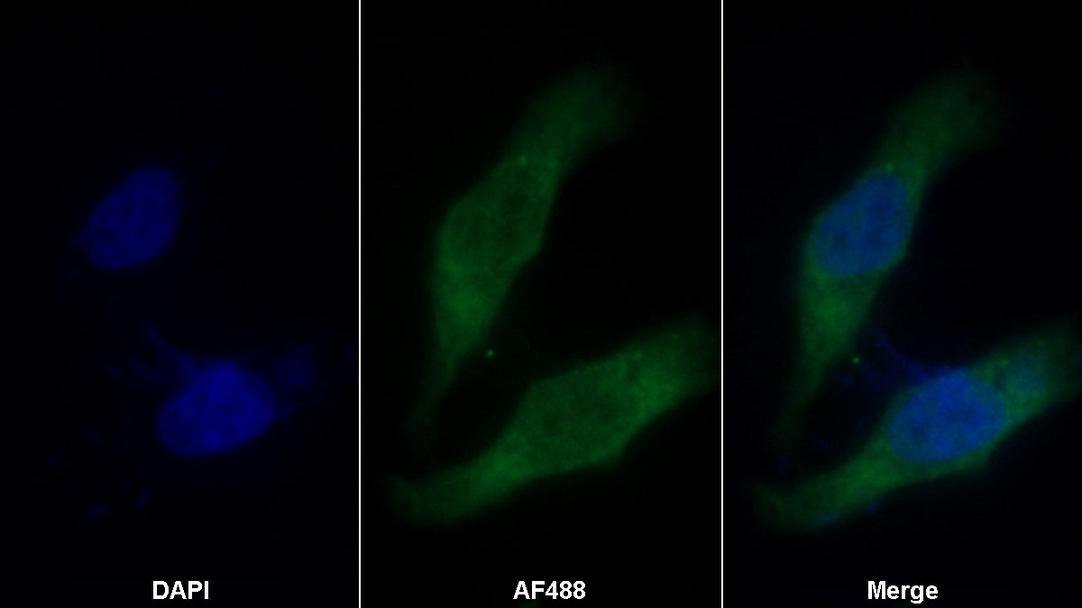 Monoclonal Antibody to Vascular Endothelial Growth Factor 165 (VEGF165)