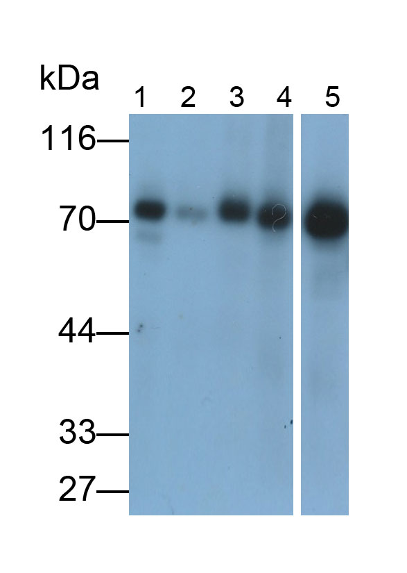 Monoclonal Antibody to Vascular Endothelial Growth Factor 165 (VEGF165)