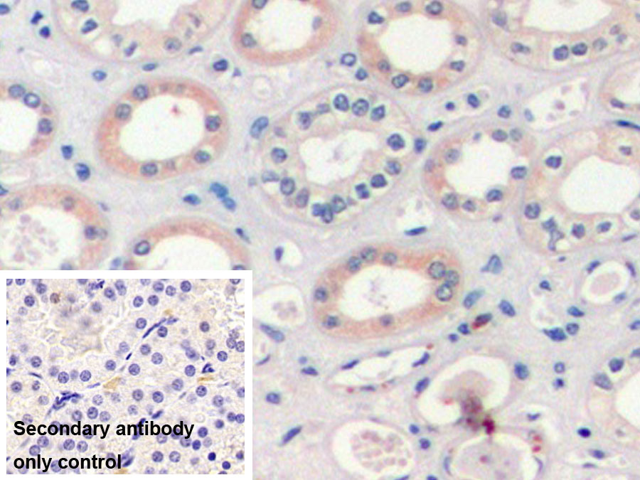 Monoclonal Antibody to Vascular Endothelial Growth Factor 165 (VEGF165)