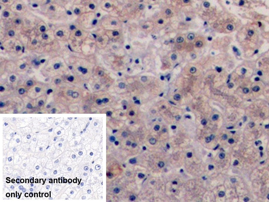 Monoclonal Antibody to Vascular Endothelial Growth Factor 165 (VEGF165)