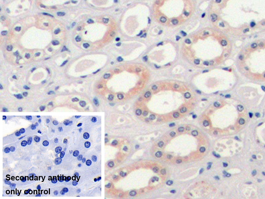 Monoclonal Antibody to Vascular Endothelial Growth Factor 165 (VEGF165)