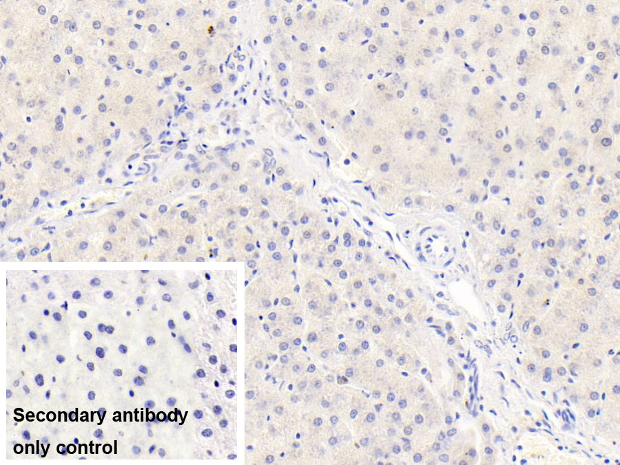 Monoclonal Antibody to Vascular Endothelial Growth Factor 165 (VEGF165)