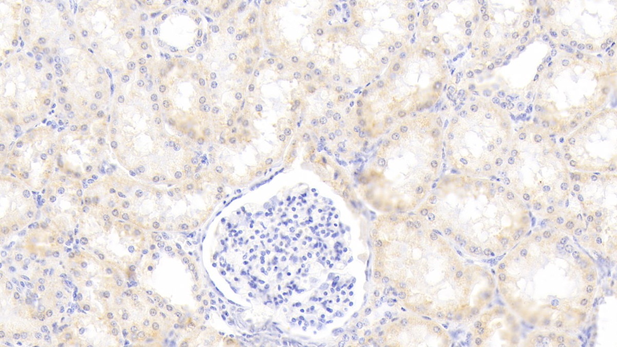 Monoclonal Antibody to Alpha-1-Antitrypsin (a1AT)