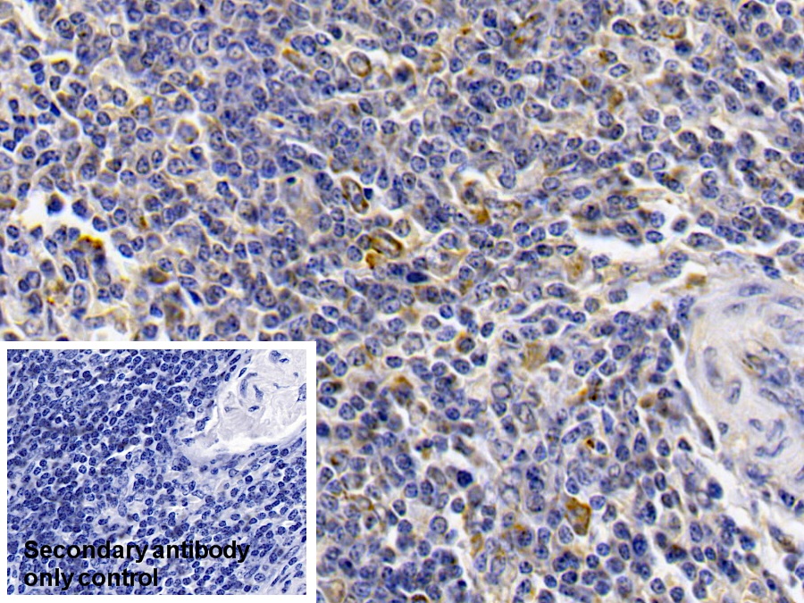 Monoclonal Antibody to Alpha-1-Antitrypsin (a1AT)