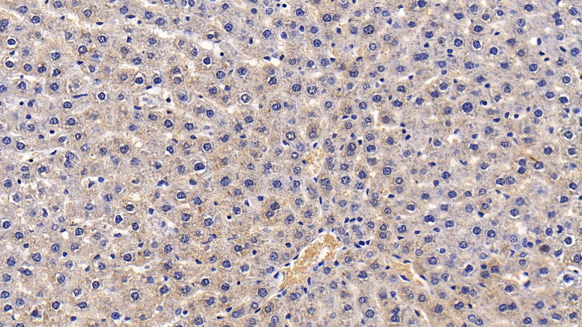 Monoclonal Antibody to Alpha-1-Antitrypsin (a1AT)