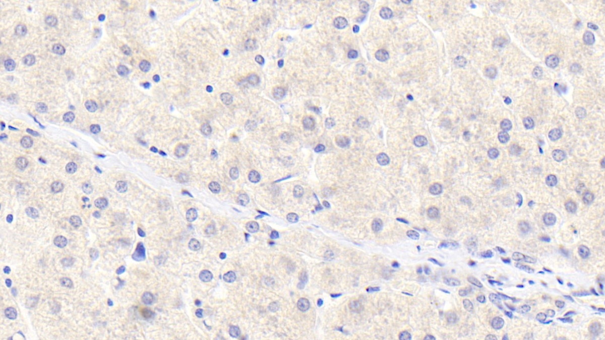 Monoclonal Antibody to Alpha-1-Antitrypsin (a1AT)