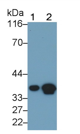 Monoclonal Antibody to Lactate Dehydrogenase B (LDHB)