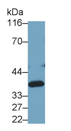 Monoclonal Antibody to Lactate Dehydrogenase B (LDHB)