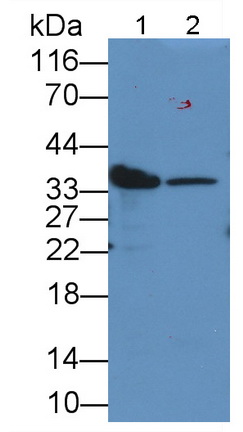 Monoclonal Antibody to Lactate Dehydrogenase B (LDHB)