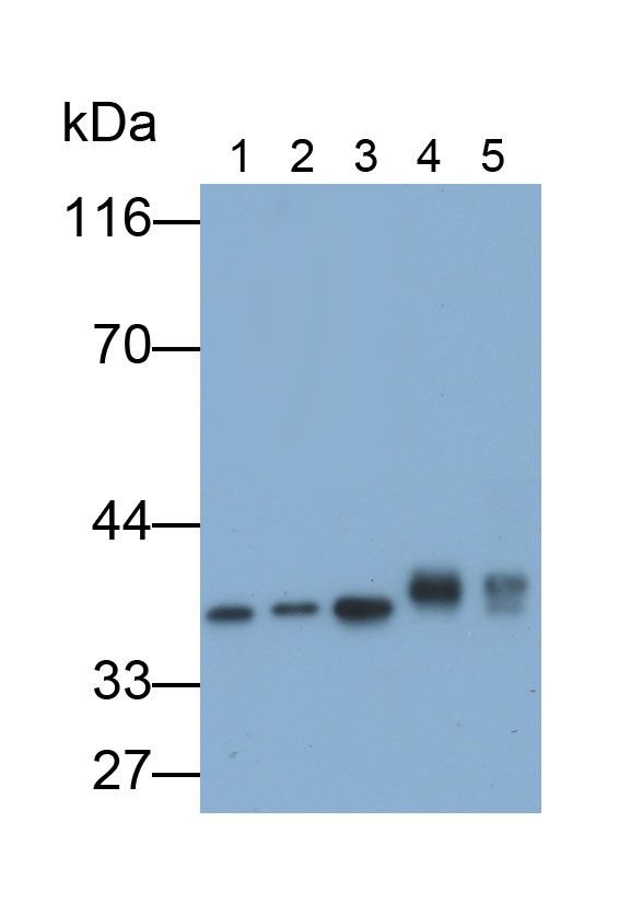 Monoclonal Antibody to Lactate Dehydrogenase B (LDHB)