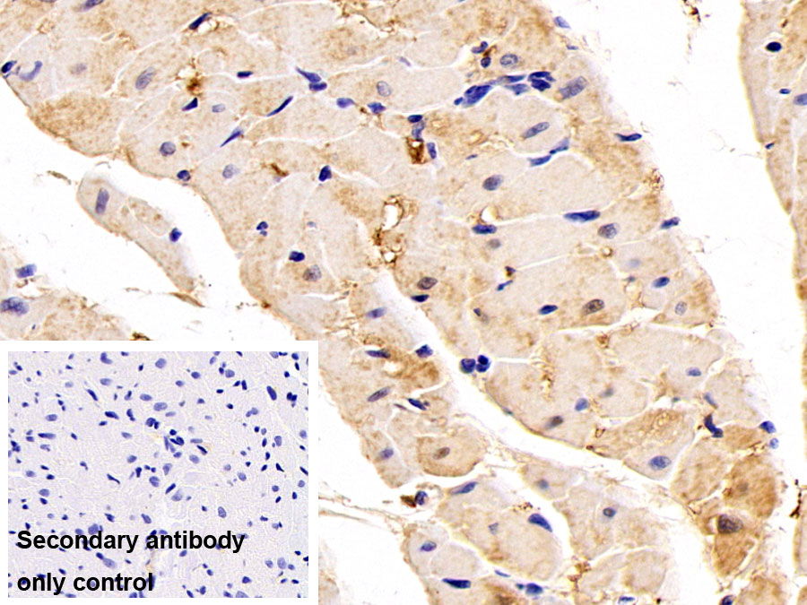 Monoclonal Antibody to Lactate Dehydrogenase B (LDHB)