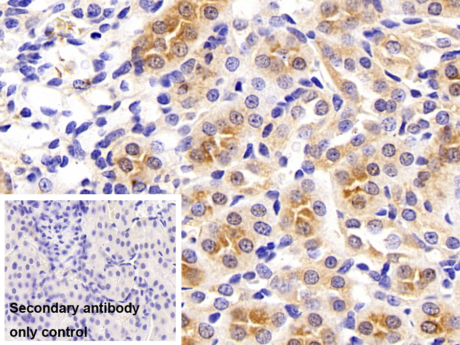 Monoclonal Antibody to Lactate Dehydrogenase B (LDHB)