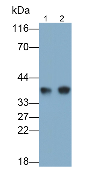 Monoclonal Antibody to Lactate Dehydrogenase B (LDHB)