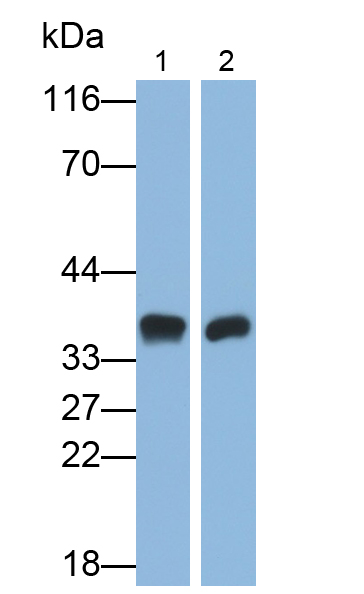 Monoclonal Antibody to Lactate Dehydrogenase B (LDHB)