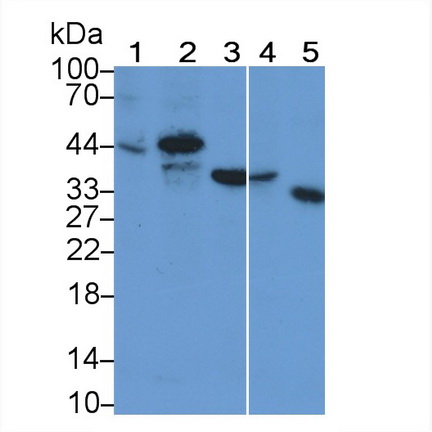 Monoclonal Antibody to TATA Binding Protein (TBP)