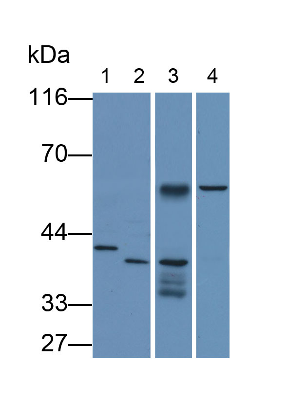 Monoclonal Antibody to TATA Binding Protein (TBP)