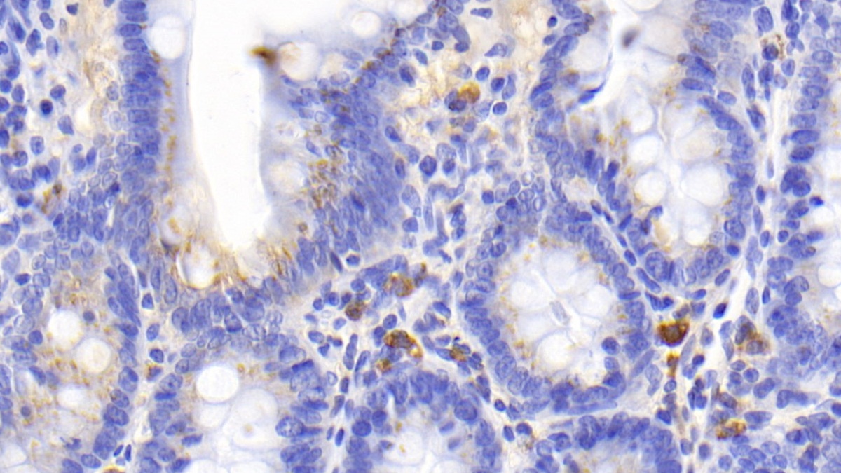 Monoclonal Antibody to Cluster Of Differentiation (CD163)