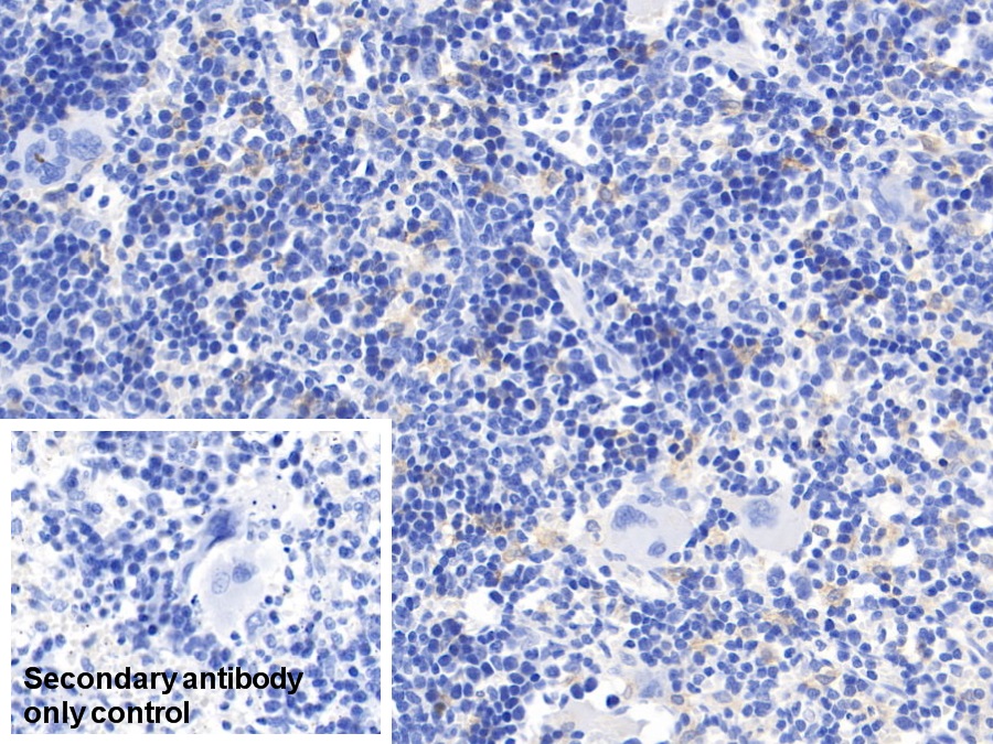 Monoclonal Antibody to Cluster Of Differentiation (CD163)