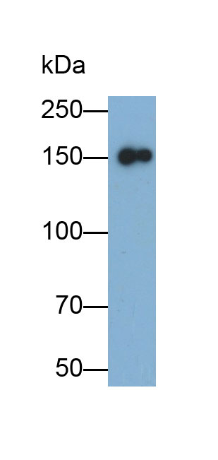 Monoclonal Antibody to Cluster Of Differentiation (CD163)