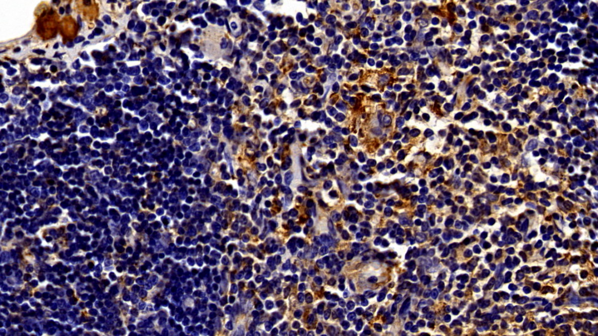 Monoclonal Antibody to Signal Transducer And Activator Of Transcription 3 (STAT3)